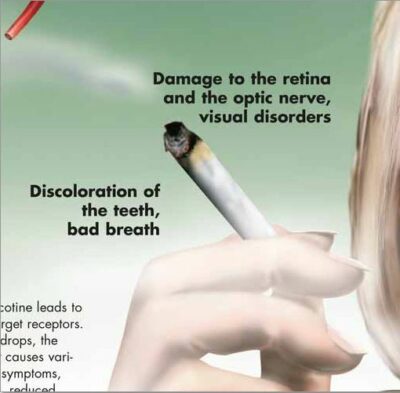 Nicotine Dependence Chart VR1793 2