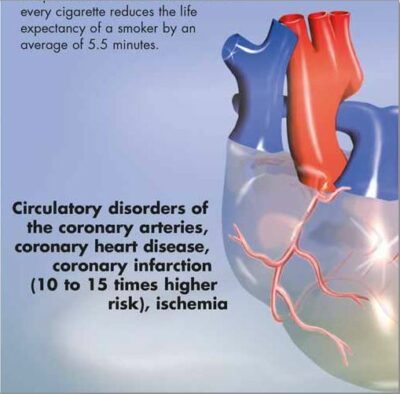 Nicotine Dependence Chart VR1793 1