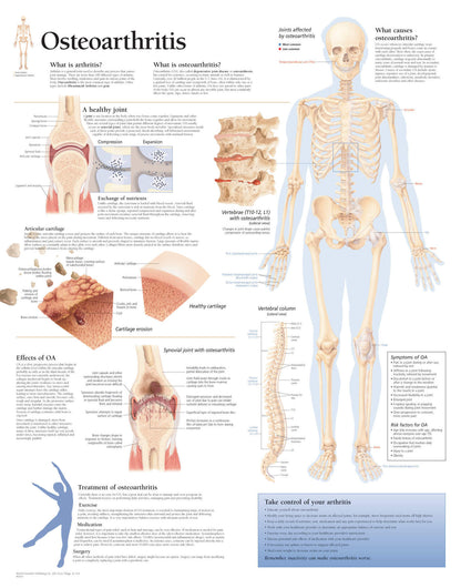 Osteoarthritis 1050