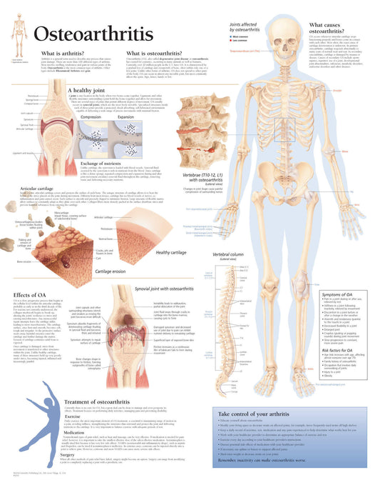 Osteoarthritis 1050