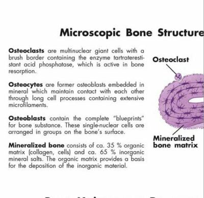 Osteoporosis Chart VR1121 1