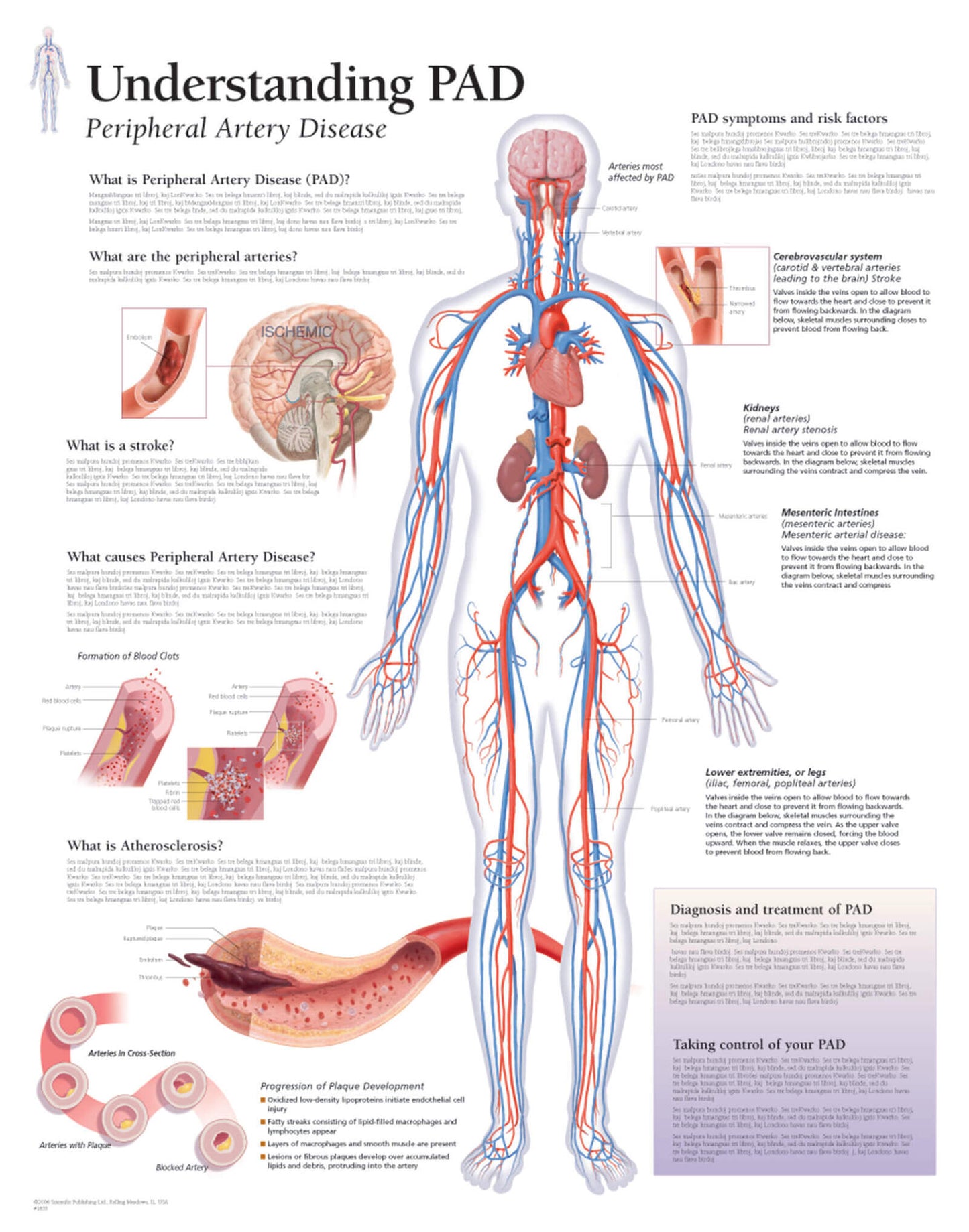 Peripheral Artery Disease (PAD) 1655
