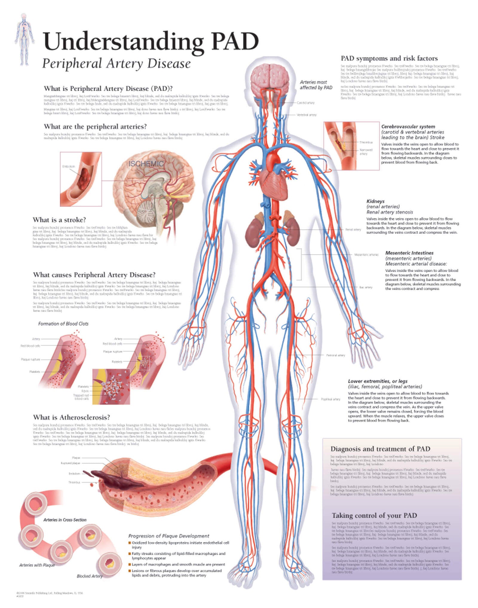 Peripheral Artery Disease (PAD) 1655