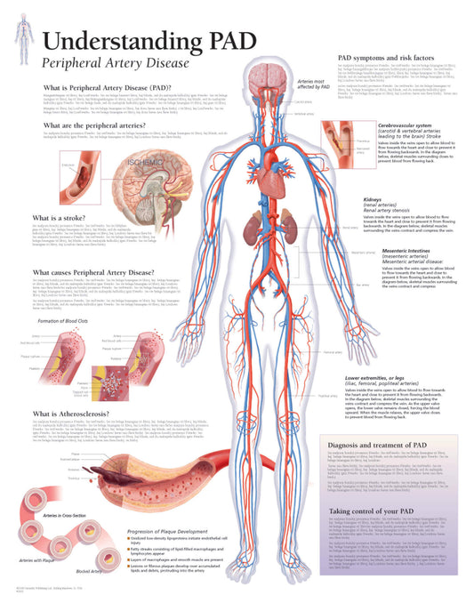 Peripheral Artery Disease (PAD) 1655