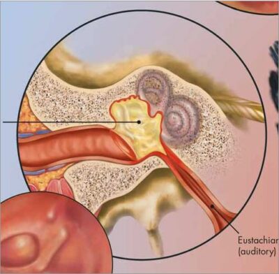 Respiratory Tract Infections Chart VR1253 2
