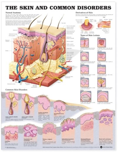 Skin and Common Disorders Anatomical Chart 9940 1