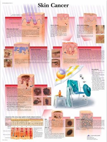 Skin Cancer Chart VR1295