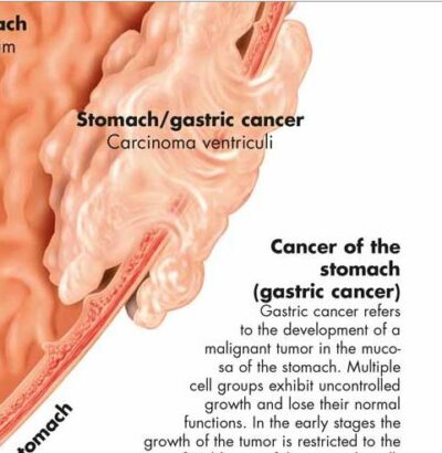 Stomach Chart VR1426 1