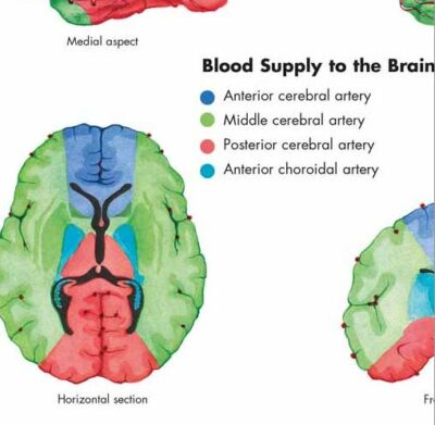 Stroke Chart VR1627 2