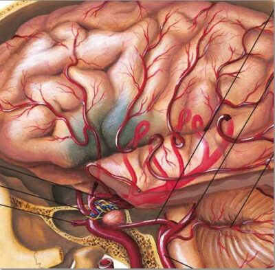 Stroke Chart VR1627 1