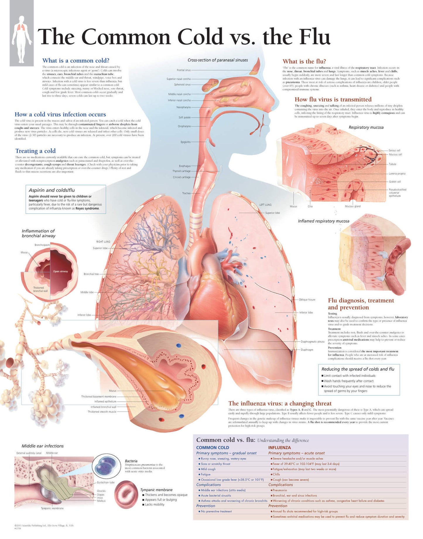 The Common Cold vs. the Flu 1356