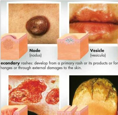 The Skin Chart VR1283 2
