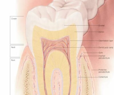 The Teeth 2300 3