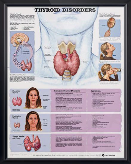 Thyroid Disorders