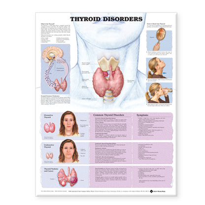 Thyroid Disorders Anatomical Chart 831X