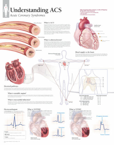 Understanding ACS 1452 1