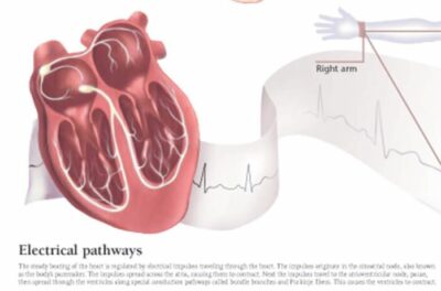 Understanding ACS 1452 3