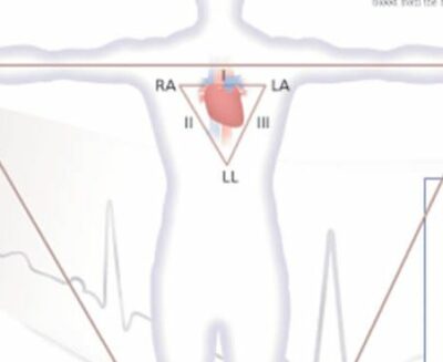 Understanding ACS 1452 2
