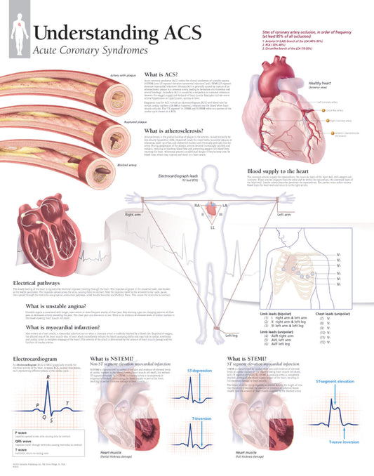 Understanding ACS 1452