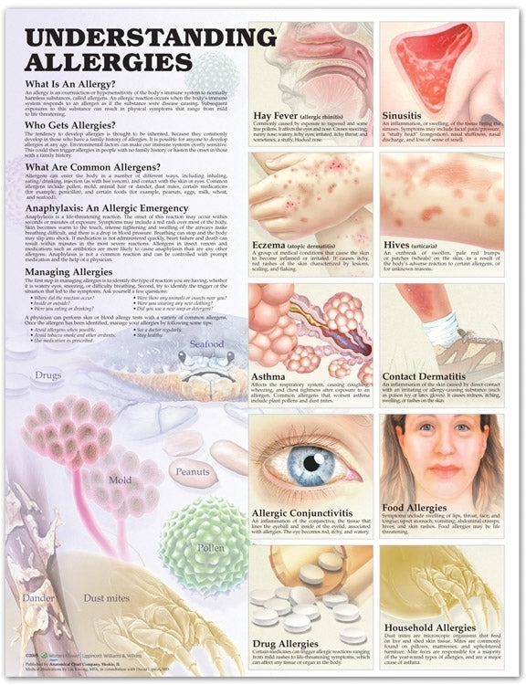 Understanding Allergies Anatomical Chart 9864