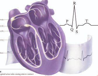 Understanding Angina 1453 2
