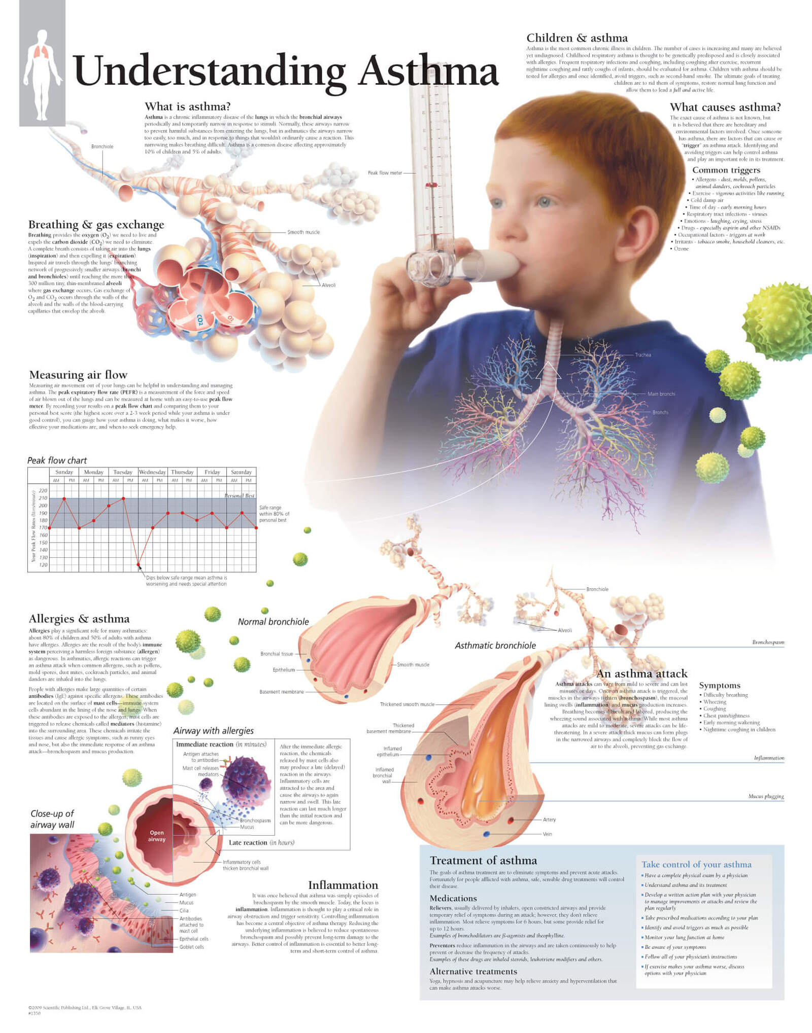 Understanding Asthma 1350