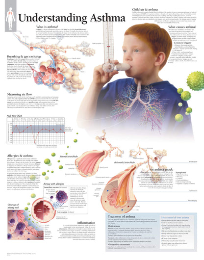 Understanding Asthma 1350
