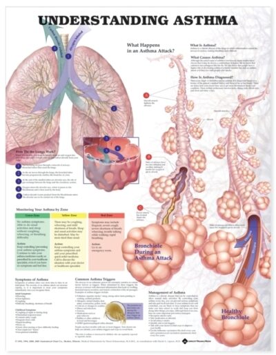 Understanding Asthma Anatomical Chart 9862 1