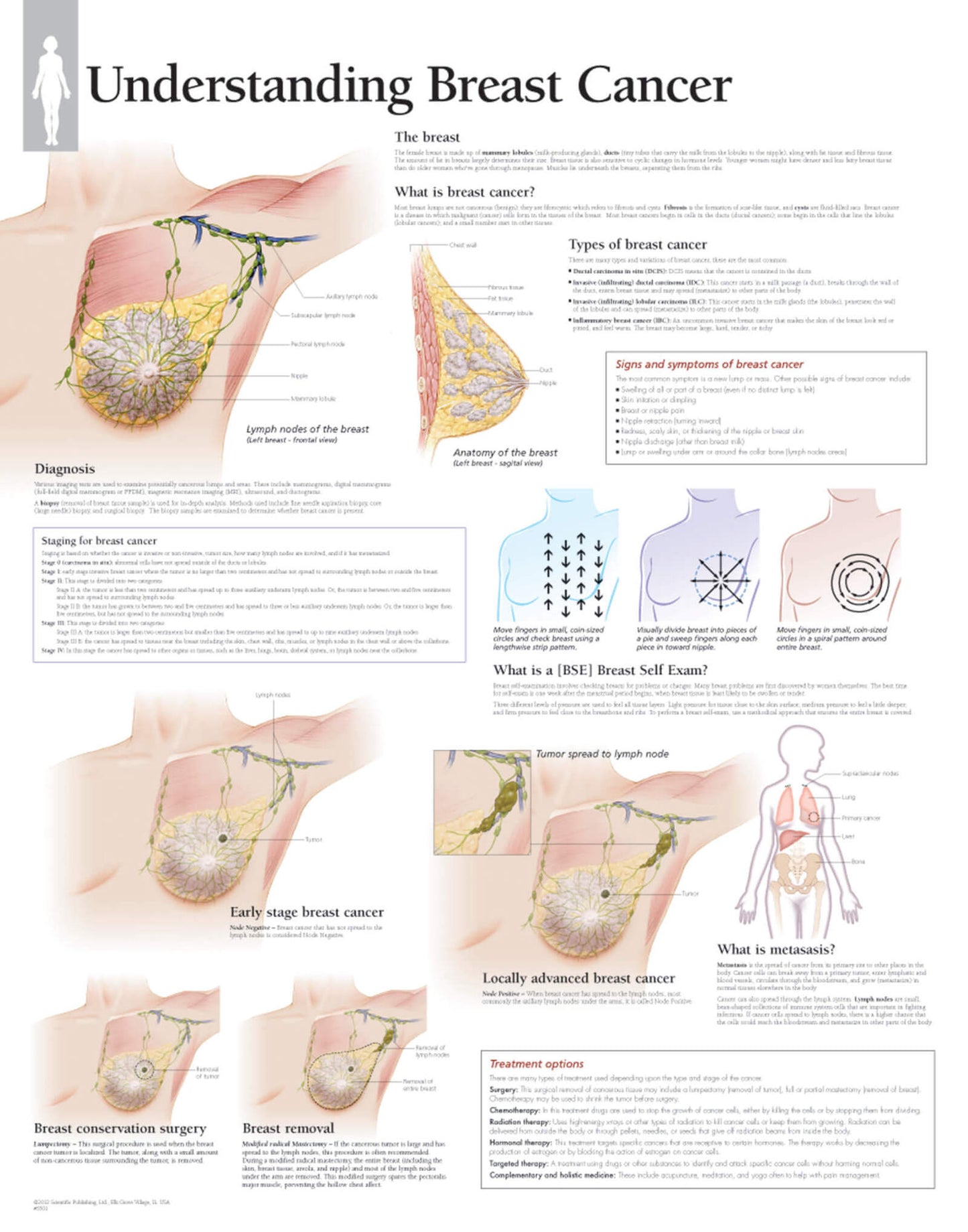 Understanding Breast Cancer 5501
