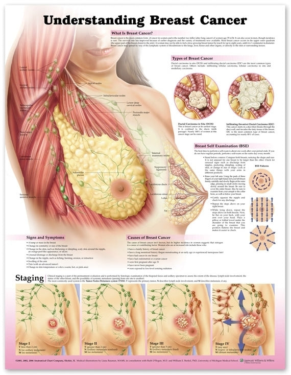 Understanding Breast Cancer 9758
