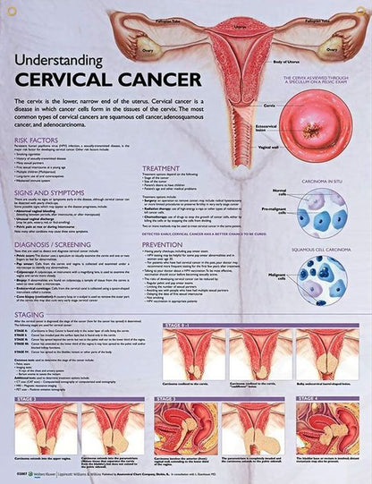 Understanding Cervical Cancer
