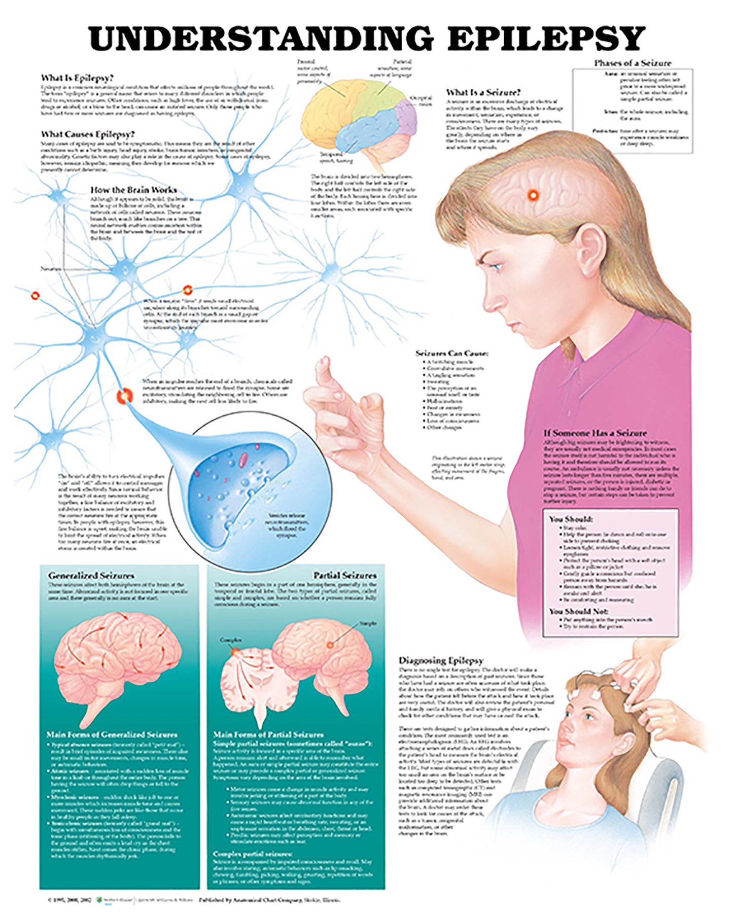 Understanding Epilepsy Anatomical Chart 9867