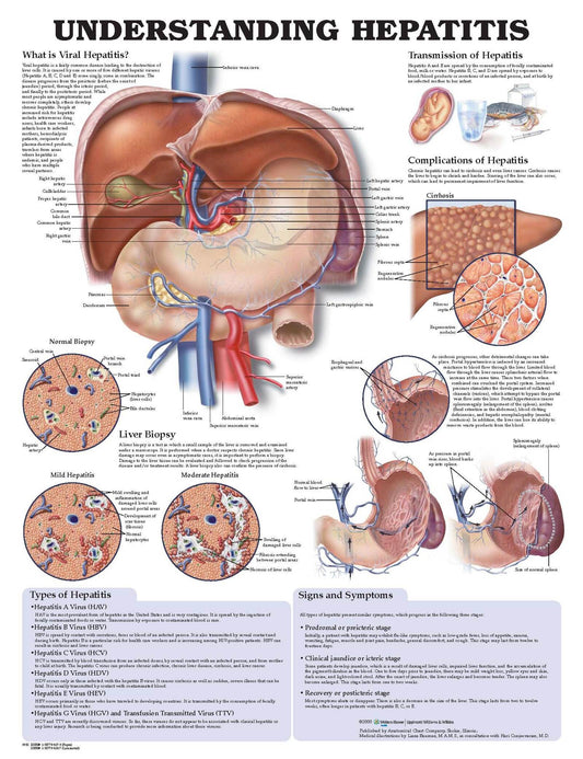 Understanding Hepatitis Anatomical Chart 9992