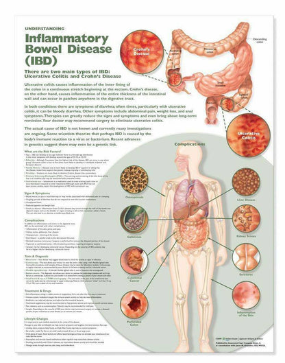 Understanding Inflammatory Bowel Disease