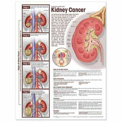 Understanding Kidney Cancer 1