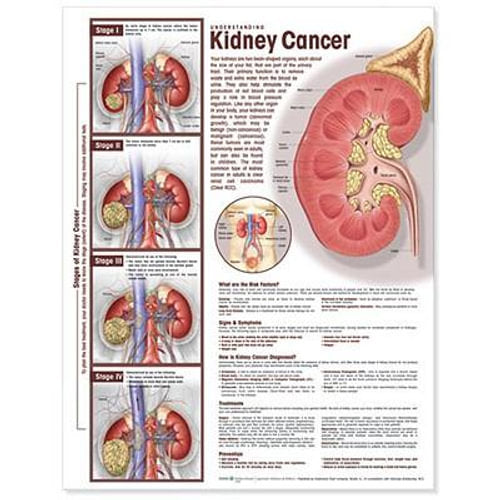 Understanding Kidney Cancer