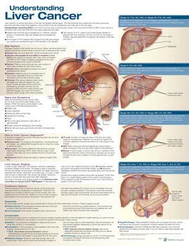 Understanding Liver Cancer