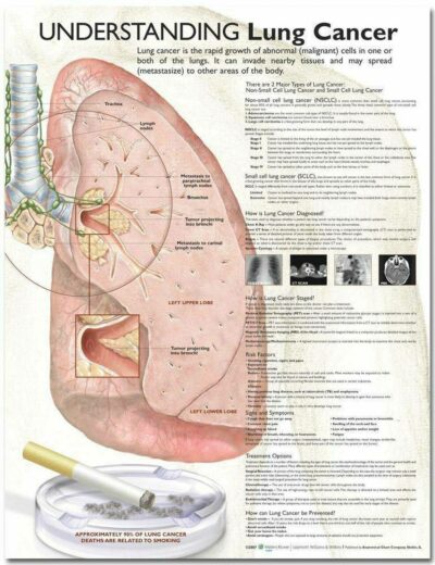Understanding Lung Cancer 1