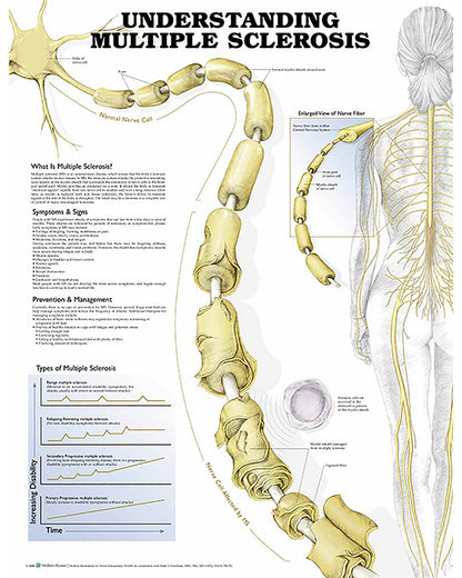 Understanding Multiple Sclerosis Anatomical Chart 9716