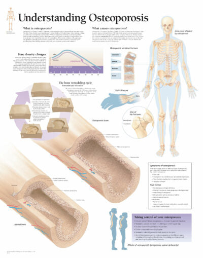 Understanding Osteoporosis 1153 1