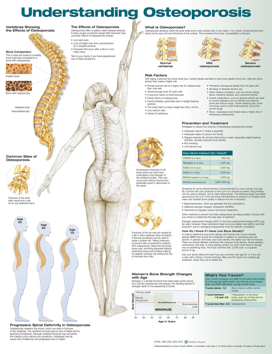 Understanding Osteoporosis 9881