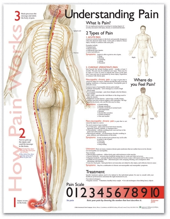 Understanding Pain Anatomical Chart 9839