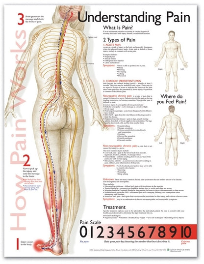 Understanding Pain Anatomical Chart 9839