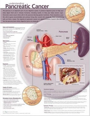 Understanding Pancreatic Cancer
