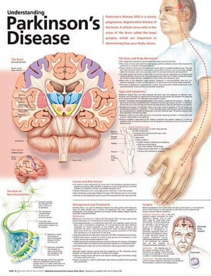 Understanding Parkinson’s Disease Anatomical Chart 9978
