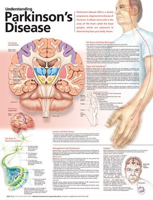 Understanding Parkinson’s Disease Anatomical Chart 9978