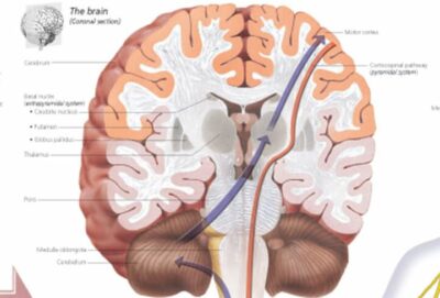 Understanding Parkinson’s Disease 2750 3