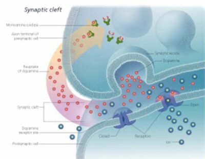 Understanding Parkinson’s Disease 2750 2
