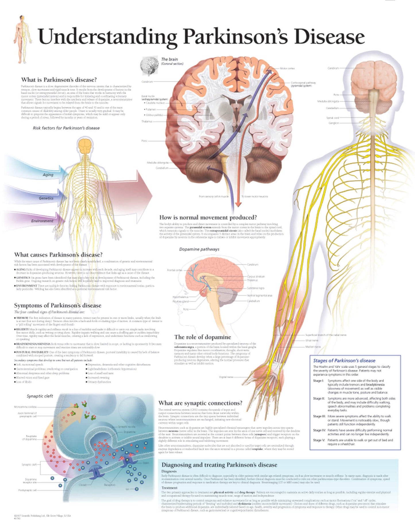 Understanding Parkinson’s Disease 2750