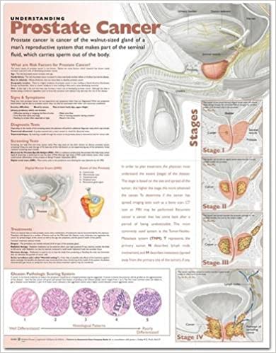 Understanding Prostate Cancer